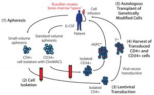 Figure 1: A cell-delivered gene therapy process begins with (1) apheresis, in which granulocyte colony stimulating factor (G-CSF) is administered to stimulate production of stem cells and their release into blood. Small-volume apheresis is taken for CD4+ T-cell isolation, and larger volumes are taken for CD34+ hematopoietic stem progenitor cells (HSPCs). After (2) a cell isolation step to purify the desired cell populations (T cells or HSPCs), purified cells are transduced with a therapeutic lentiviral vector (3). Following harvest of transduced T cells and HSPCs (4), modified cells are collected and cryopreserved. Finally (5), genetically modified autologous cells are transplanted back to the same patient. Busulfan chemotherapy is administered before transplantation to create “space” in the patient’s bone marrow for the therapeutically modified cells. 