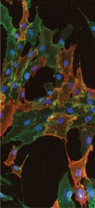 Immunocytochemical staining shows cultured human bone marrow–derived mesenchymal stem cells stained with STRO-1 and CD90 antibodies. Nuclei of the cells are visualized using DAPI (blue). EMD MILLIPORE