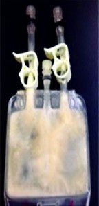 (photo) a 30-mL Celsius bag containing MAb-C BDS at 120 mg/mL after being subjected to controlled fast-freezing protocol using liquid nitrogen