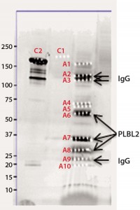 Figure 2b: Chromatographic separation of CHOP impurities from the product; CHOP- positive fractions 8–20 were pooled, concentrated, and analyzed on a sodium- dodecyl sulfate polyacrylamide gel electrophoresis (SDS-PAGE) gel.  