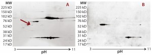 Figure 2: Locating the immunoreactive spot on 2D gels for HCP identification by LC-MS; DS sample was resolved on two identical 2D gels. One 2D gel was stained using a silver stain kit (a); the other was transferred to a nitrocellulose membrane for anti-HEK HCP Western blotting (b). An arrow on the silver-stained gel (a) points to protein spots that matched the Western blot spots (c). Undigested DS sample was labeled with Cy2 dye (shown in green), thrombin- digested DS sample was labeled with Cy3 dye (shown in red). The arrow points to a major 70-kDa HCP spot that was unchanged after thrombin digestion. 
