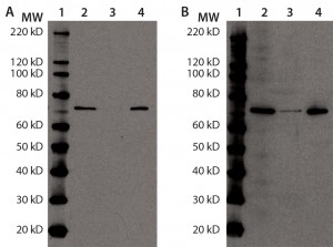 Figure 4: Immunoprecipitation of Hsp70 in DS; for (a) and (b), equal volumes of DS sample (lane 2), Hsp70 immunoprecipitation supernatant (lane 3), and Hsp70 immunoprecipitation eluate (lane 4) were denatured, reduced, and loaded onto two 4–12% SDS-PAGE gels in parallel. Lane 1 is a Magic Marker molecular weight (MW) marker from Bio-Rad Laboratories. 