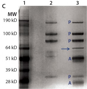 Both gels were transferred to nitrocellulose membranes and probed with anti-Hsp70 antibody (a) or anti-HEK HCP antibody (b). For immunoprecipitation of HEK HCP in DS (c), the same amount of DS was incubated with streptavidin beads either with (lane 3) or without (lane 2) a biotinylated anti-HEK HCP antibody. Proteins bound to the beads were eluted in acidic buffer and resolved by SDS-PAGE, then the gel was silver stained and product bands identified with a label “P” and anti-HEK HCP antibody bands (heavy chain and light chain) with a label “A.” The unique HCP band around 70 kDa is marked by an arrow.