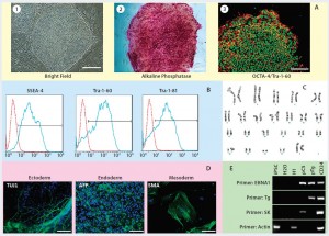 Figure 2: Human iPSCs generated using a feeder-dependent system during proof-of-principle stage (stage 1); (a) an iPSC colony positively stained with alkaline phosphatase (AP) and iPSCs expressing pluripotency markers OCT4 and TRA-1-60 (b) iPSCs expressing the pluripotent stem cell surface markers SSEA4, TRA-1-60, and TRA-1-81 (blue) with an isotype control (red); (c) iPSCs demonstrated normal karyotype after 10 passages; (d) iPSCs differentiated into embryoid bodies and readily expressing the markers for early ectoderm (TUJ1), endoderm (alpha-feto protein, AFP), and mesoderm (smooth muscle actin, SMA); (e) semiqualified PCR analysis of the iPSC sample exhibited plasmid clearance at P6. The top row shows plasmid (if applicable) or genomic DNA purified from different samples: iPSCs generated on feeders, water, human embryonic stem cells (H1), pEB-C5 plasmid, pEB-Tg plasmid, and CD34+ cells four days after nucleofection with pEB-C5 and pEB-Tg plasmids. Vertical column from top to bottom shows primers for EBNA1 vector, pEB-Tg, pEB- C5 (SK), and reference (actin). Scale bar in all images is 250 µm, except for (d) 125 µm. 