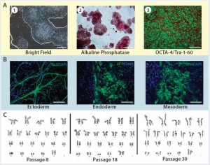 Figure 3: Karyotype analysis at different passage levels for human iPSCs generated using the Lonza CGMP-compatible, feeder-independent cell culture system; (a) iPSCs generated on the feeder-free system, some positively stained with alkaline phosphatase (AP), and some expressing pluripotency markers OCT4 and TRA-1-60; (b) iPSCs generated in the feeder-free system and differentiated into embryoid bodies, readily expressing markers for early ectoderm (TUJ1), endoderm (AFP), and mesoderm (SMA); (c) karyotype analysis of the same iPSC cell line generated under a CGMP- compliant process and serially subcultured at different passages — P8, P18, and P30. Scale bar in all images is 125 µm, except for (a) left and middle images, 500 µm.