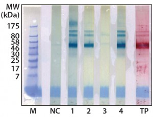 Figure 2: Western blot cross-reactivity after antibody immune adsorption against alpha galactosidase, 500 ng (αGal) protein per strip; MW of moss-αGal = 46 kDa 